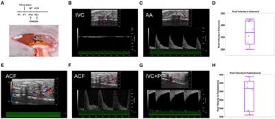 Molecular Changes in Prepubertal Left Ventricular Development Under Experimental Volume Overload